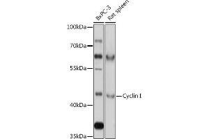 Western blot analysis of extracts of various cell lines, using Cyclin I antibody (ABIN7266570) at 1:1000 dilution. (Cyclin I 抗体  (AA 257-377))