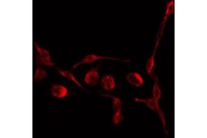 ABIN6266642 staining COS7 by IF/ICC. (TGFB3 抗体)