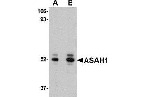 Western Blotting (WB) image for anti-N-Acylsphingosine Amidohydrolase (Acid Ceramidase) 1 (ASAH1) (C-Term) antibody (ABIN1030257) (ASAH1 抗体  (C-Term))