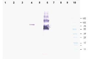 Image no. 1 for anti-Ankyrin Repeat Domain 26 (ANKRD26) (AA 1-15), (N-Term) antibody (ABIN401330) (ANKRD26 抗体  (N-Term))