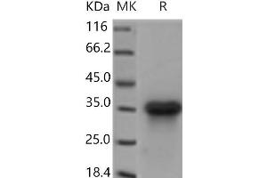 Western Blotting (WB) image for Lymphotoxin beta Receptor (TNFR Superfamily, Member 3) (LTBR) protein (His tag) (ABIN7321202)
