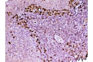 IHC testing of FFPE rat spleen tissue with ADA antibody at 1ug/ml. (ADA 抗体  (AA 2-238))