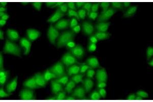 Immunofluorescence analysis of MCF7 cells using GTF2F1 Polyclonal Antibody (GTF2F1 抗体)