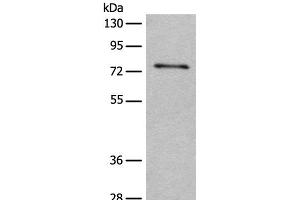 Western blot analysis of Human hepatocellular carcinoma 2 tissue lysate using ADGRE3 Polyclonal Antibody at dilution of 1:400 (EMR3 抗体)