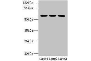 Western blot All lanes: PIK3R3 antibody at 3. (PIK3R3 抗体  (Regulatory Subunit Gamma))
