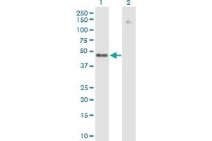 Western Blot analysis of ZNF776 expression in transfected 293T cell line by ZNF776 MaxPab polyclonal antibody.