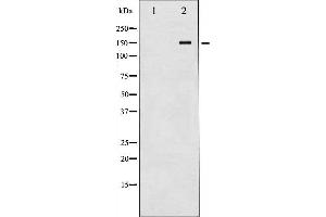 Western blot analysis of Met expression in HepG2 whole cell lysates,The lane on the left is treated with the antigen-specific peptide. (c-MET 抗体  (C-Term))