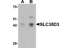 Western Blotting (WB) image for anti-Solute Carrier Family 35, Member D3 (SLC35D3) (C-Term) antibody (ABIN1077364) (SLC35D3 抗体  (C-Term))