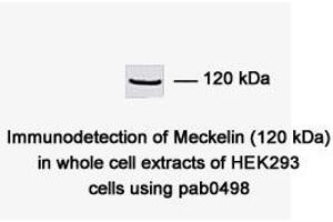 Image no. 1 for anti-Transmembrane Protein 67 (TMEM67) (C-Term) antibody (ABIN347657) (TMEM67 抗体  (C-Term))