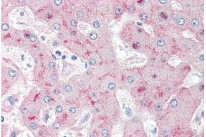 Human Liver (formalin-fixed, paraffin-embedded) stained with LRP1 antibody ABIN351532 at 10 ug/ml followed by biotinylated anti-mouse IgG secondary antibody ABIN481714, alkaline phosphatase-streptavidin and chromogen. (LRP1 抗体)