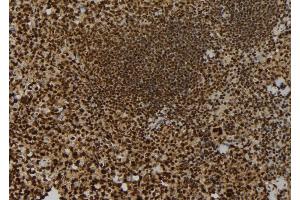 ABIN6273703 at 1/100 staining Mouse spleen tissue by IHC-P. (KIF23 抗体  (Internal Region))