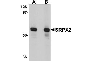 Western Blotting (WB) image for anti-Sushi-Repeat Containing Protein, X-Linked 2 (SRPX2) (N-Term) antibody (ABIN1031586) (SRPX2 抗体  (N-Term))