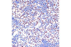 Immunohistochemistry of paraffin-embedded mouse spleen using PELP1 antibody (ABIN6130610, ABIN6145442, ABIN6145443 and ABIN6217403) at dilution of 1:100 (40x lens). (PELP1 抗体)