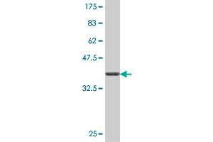 Western Blot detection against Immunogen (37. (PRPS1 抗体  (AA 1-100))