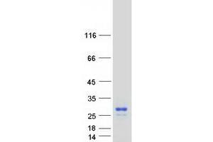 Western Blotting (WB) image for Glycoprotein M6A (GPM6A) (Transcript Variant 2) protein (Myc-DYKDDDDK Tag) (ABIN2722167)