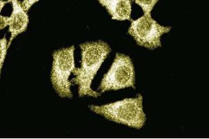 Immunofluorescent staining of HeLa cells with anti-Itch antibody. (ITCH 抗体  (AA 114-220))