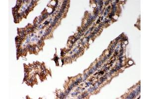 IHC testing of FFPE mouse intestine with HLA-C antibody. (HLA-C 抗体)