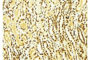 ABIN6269069 at 1/100 staining Mouse kidney tissue by IHC-P. (SNAIL 抗体  (C-Term))