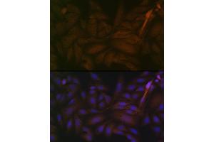 Immunofluorescence analysis of U-2 OS cells using PP2A alpha + beta Rabbit mAb (ABIN7269686) at dilution of 1:100 (40x lens). (PPP2CB 抗体)
