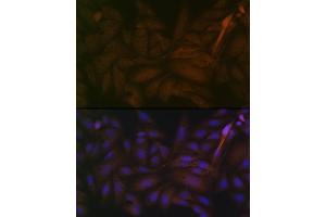 Immunofluorescence analysis of U-2 OS cells using PP2A alpha + beta Rabbit mAb (ABIN7269686) at dilution of 1:100 (40x lens). (PPP2CB 抗体)