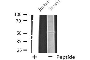 Western blot analysis of extracts from Jurkat cells, using EIF2B3 antibody. (EIF2B3 抗体  (Internal Region))