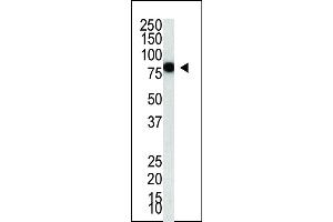 Western Blotting (WB) image for anti-Protein Inhibitor of Activated STAT, 4 (PIAS4) (AA 471-499), (C-Term) antibody (ABIN388062)