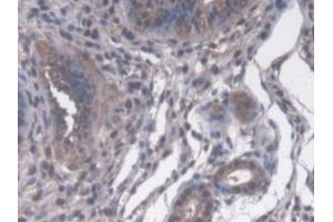 IHC-P analysis of Mouse Uterus Tissue, with DAB staining. (PPID 抗体  (AA 9-189))