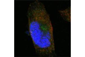 Confocal immunofluorescence analysis of PANC-1 cells using SORL1 mouse mAb (green). (SORL1 抗体)