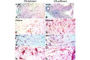 Immunohistochemistry of C5-d and C5-s mice with EAE. (豚鼠 Spinal Cord)