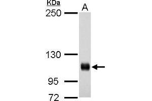 WB Image Rb antibody detects Rb protein by western blot analysis. (Retinoblastoma 1 抗体  (C-Term))