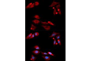 Immunofluorescence (IF) image for anti-GDNF Family Receptor alpha 1 (GFRA1) antibody (ABIN1876561) (GFRA1 抗体)