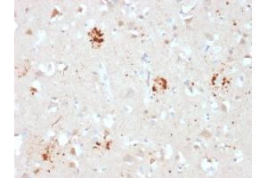 Formalin-fixed, paraffin-embedded human Brain stained with Ubiquitin Mouse Monoclonal Antibody (UBB/2122). (Ubiquitin B 抗体  (AA 1-119))