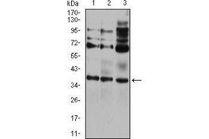Western blot analysis using CIDEC mouse mAb against HEK293 (1), A431 (2), and HCT116 (3) cell lysate. (CIDEC 抗体  (AA 53-141))