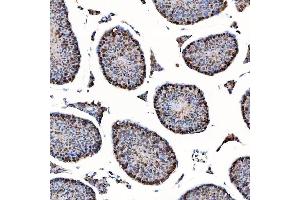 IHC analysis of SAP130 using anti-SAP130 antibody (ABIN7601247).