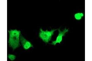 Image no. 11 for anti-Zinc Finger and SCAN Domain Containing 18 (ZSCAN18) antibody (ABIN1501857)