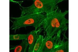 ICC/IF test of HeLa cells treated with sodium butyrate using recombinant H3K27ac antibody (red). (Recombinant Histone 3 抗体  (acLys27))