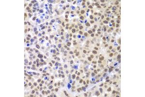 Immunohistochemistry of paraffin-embedded mouse cancer using LHX4 antibody at dilution of 1:100 (x400 lens). (LHX4 抗体)