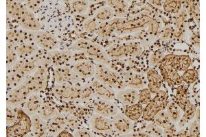 ABIN6269136 at 1/100 staining Rat kidney tissue by IHC-P. (FGFR1 抗体  (C-Term))