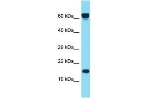 Host: Rabbit Target Name: C1orf86 Sample Type: ACHN Whole cell lysates Antibody Dilution: 1. (C1orf86 抗体  (C-Term))