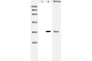 L2 rat heart lysates probed with Anti Lambda Light Chain Polyclonal Antibody, Unconjugated (ABIN704321) at 1:200 overnight at 4 °C. (Lambda-IgLC 抗体  (AA 41-106))