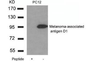 Western blot analysis of extracts from PC12 cells using Melanoma-associated antigen D1 Antibody and the same antibody preincubated with blocking peptide. (MAGED1 抗体)