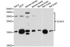 Western blot analysis of extracts of various cell lines, using VEGFA antibody. (VEGFA 抗体  (AA 111-161))