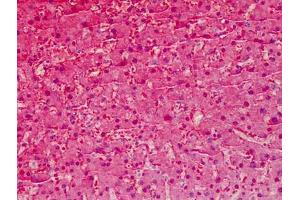 Human Liver: Formalin-Fixed, Paraffin-Embedded (FFPE) (Liver Arginase 抗体  (AA 1-145))