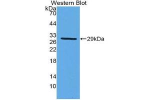 Western Blotting (WB) image for anti-Damage-Specific DNA Binding Protein 2, 48kDa (DDB2) (AA 166-383) antibody (ABIN1980395) (DDB2 抗体  (AA 166-383))