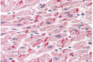 Human Heart (formalin-fixed, paraffin-embedded) stained with JUP antibody ABIN305904 at 5 ug/ml followed by biotinylated anti-goat IgG secondary antibody ABIN481715, alkaline phosphatase-streptavidin and chromogen. (JUP 抗体  (AA 732-745))