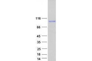 Western Blotting (WB) image for USO1 Homolog, Vesicle Docking Protein (USO1) protein (Myc-DYKDDDDK Tag) (ABIN2735084)