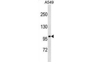 Western Blotting (WB) image for anti-Fanconi Anemia, Complementation Group B (FANCB) antibody (ABIN2999895) (FANCB 抗体)