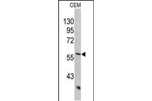 Western blot analysis of KRT10 antibody in CEM cell line lysates (35ug/lane) (Keratin 10 抗体  (AA 318-346))