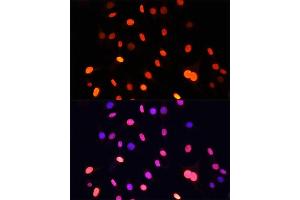 Immunofluorescence analysis of C6 cells using Pan DiMethyl-lysine antibody (ABIN7266777) at dilution of 1:100. (Dimethyl-Lysine 抗体)