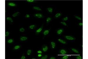 Immunofluorescence (IF) image for anti-Eukaryotic Translation Initiation Factor 4E Binding Protein 1 (EIF4EBP1) (AA 1-118) antibody (ABIN560717)